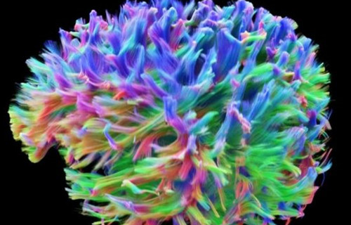 大脑回路成像1_英语新闻