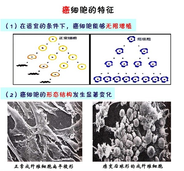新东方名师版高中生物知识点:癌细胞的特征