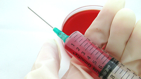 A syringe with blood