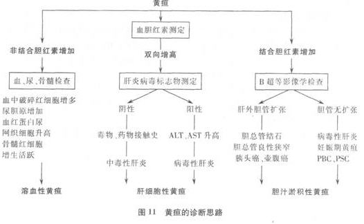 2015临床助理医师实践技能必考题:黄疸的鉴别诊断与诊断