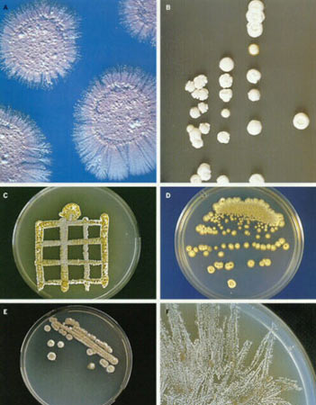 微生物学 > 正文    放线菌在固体培养基上形成与细菌不同的菌落特征