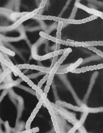 链霉菌的各种孢子丝形态