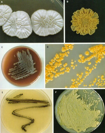 > 正文    放线菌在固体培养基上形成与细菌不同的菌落特征,放线菌