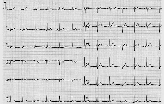 医师实践技能考试辅导:行针手法
